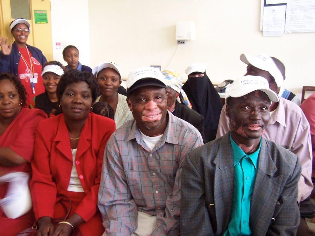 Vitiligo patients Kenyatta Hospital